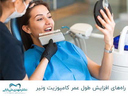 زيادة عمر الكمبوزيت – طرق جعل الكمبوزيت يدوم طويلاً