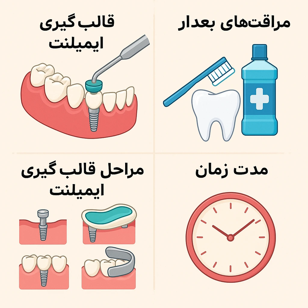 مراحل زراعة الأسنان + المدة والرعاية اللاحقة - دكتور بهاري سيباهريان لطب الأسنان