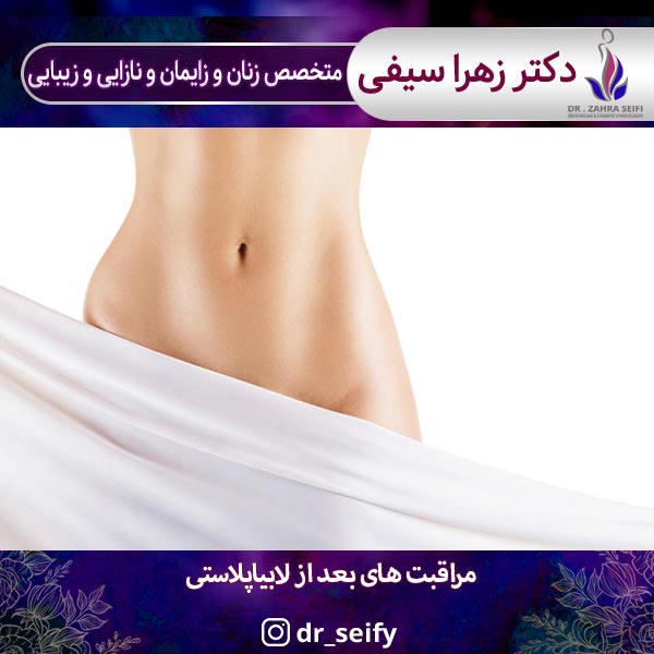 Care after labiaplasty ✅ Tips you should know Dr. Zahra Saifi
