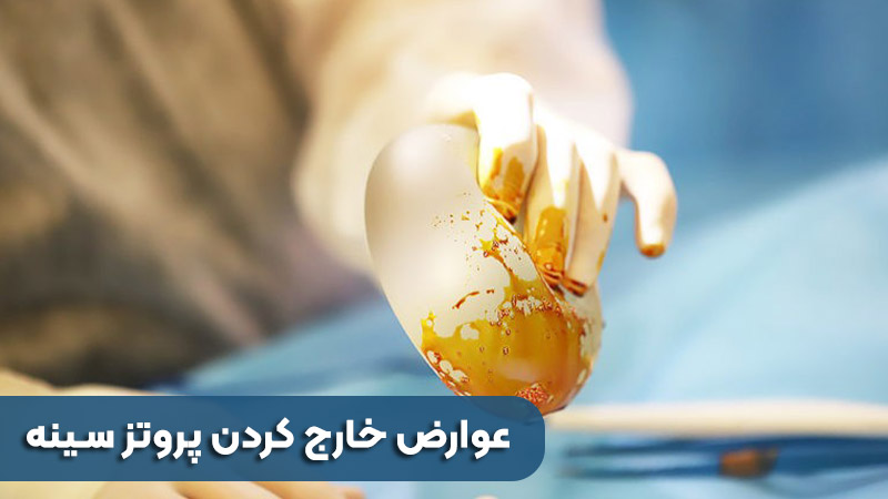 مضاعفات إزالة الثدي الاصطناعي