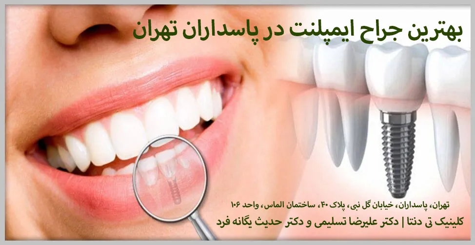 بهترین جراح ایمپلنت در پاسداران تهران 1404 | کلینیک Tdenta