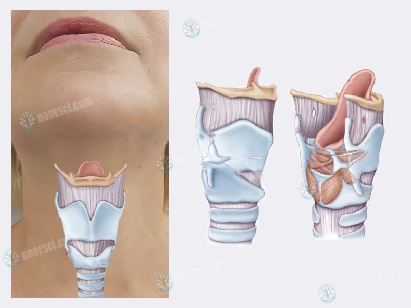 Voice disorders and larynx problems