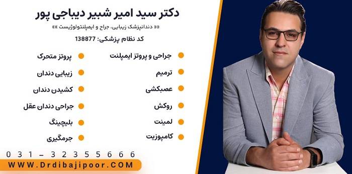 بهترین دکتر لمینت سرامیکی اصفهان 1404 + لیست قیمت