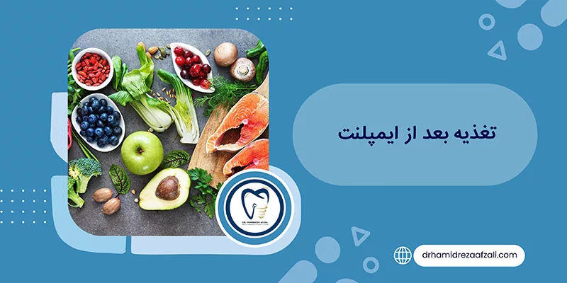 ماذا يجب أن تكون التغذية بعد عملية الزرع؟ | دكتور حميدرضا أفضلي