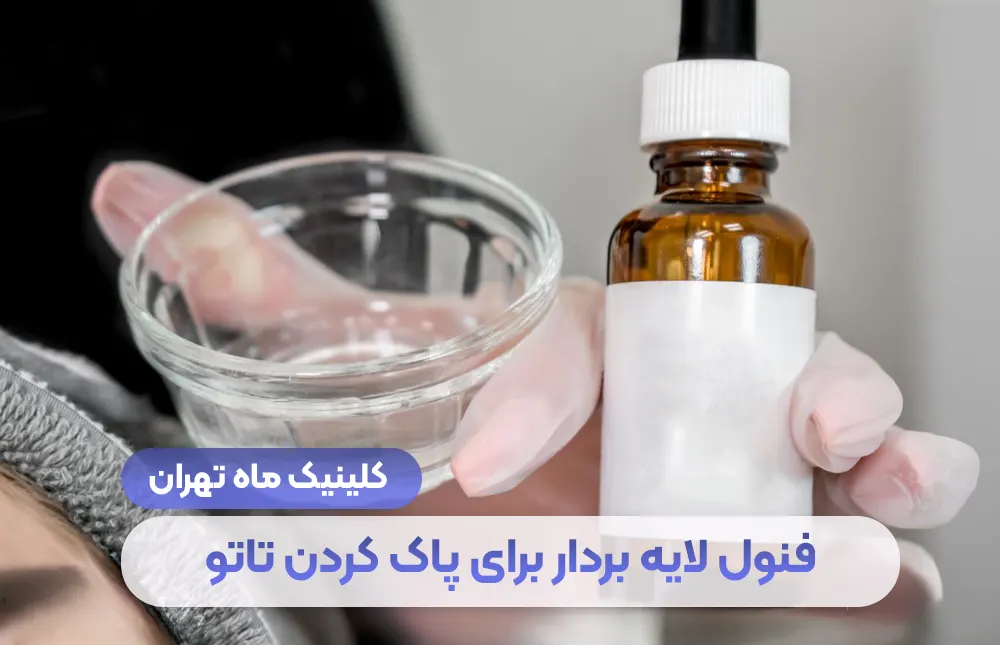 فنل لایه بردار برای پاک کردن تاتو + عوارض وحشتناک - کلینیک تهران ماه