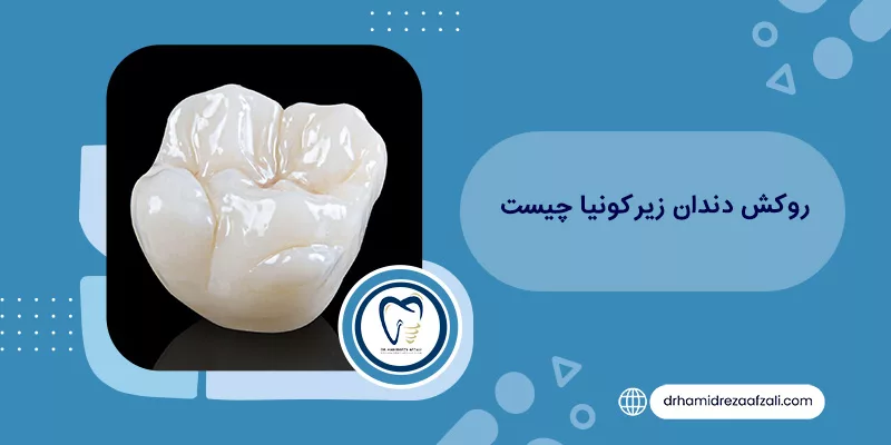 ما هي قشور الزركونيا للأسنان وما هي مميزاتها؟ | دكتور أفضلي