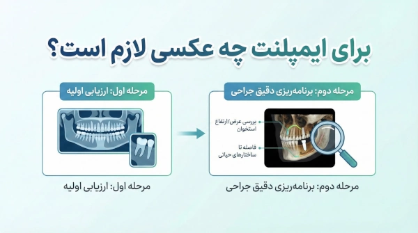 What photo is required for the implant? A complete guide before dental implants - Center for Gum and Implant Surgery, Dr. Affir and Dr. Shanae
