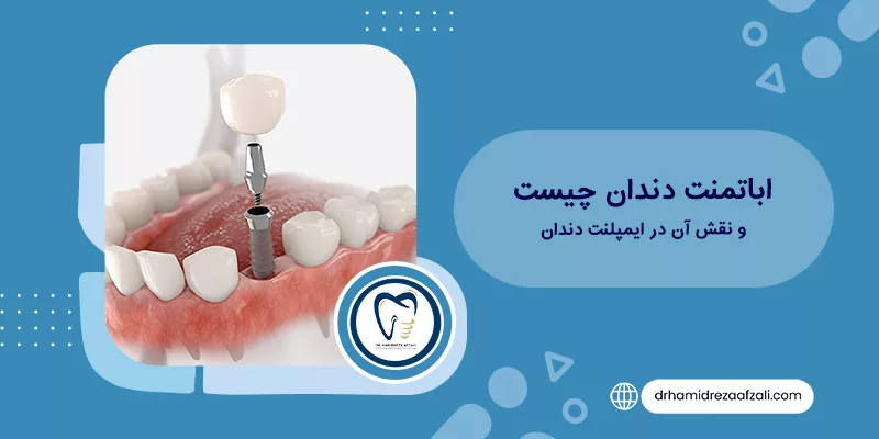 ما هي دعامة الأسنان؟ تأثيره على الزرع الدكتور حميد رضا أفضلي