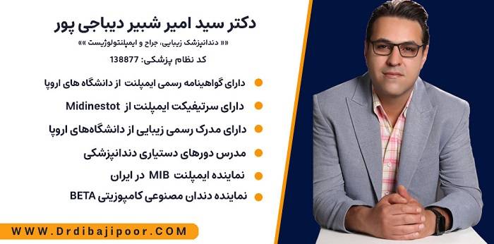 The best dental implant doctor in Isfahan Installments + no pain