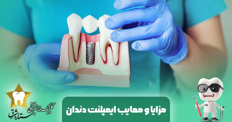 مزایا و معایب ایمپلنت دندان: راهنمای جامع برای انتخاب آگاهانه