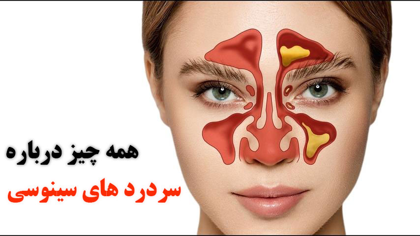 Sinus headaches: why they happen and how to get relief? | Dr. Kihani Fard