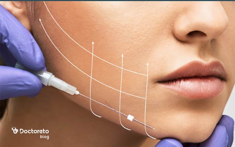 ما هو خيوط الكولاجين للوجه ومتى يتم استخدامه؟