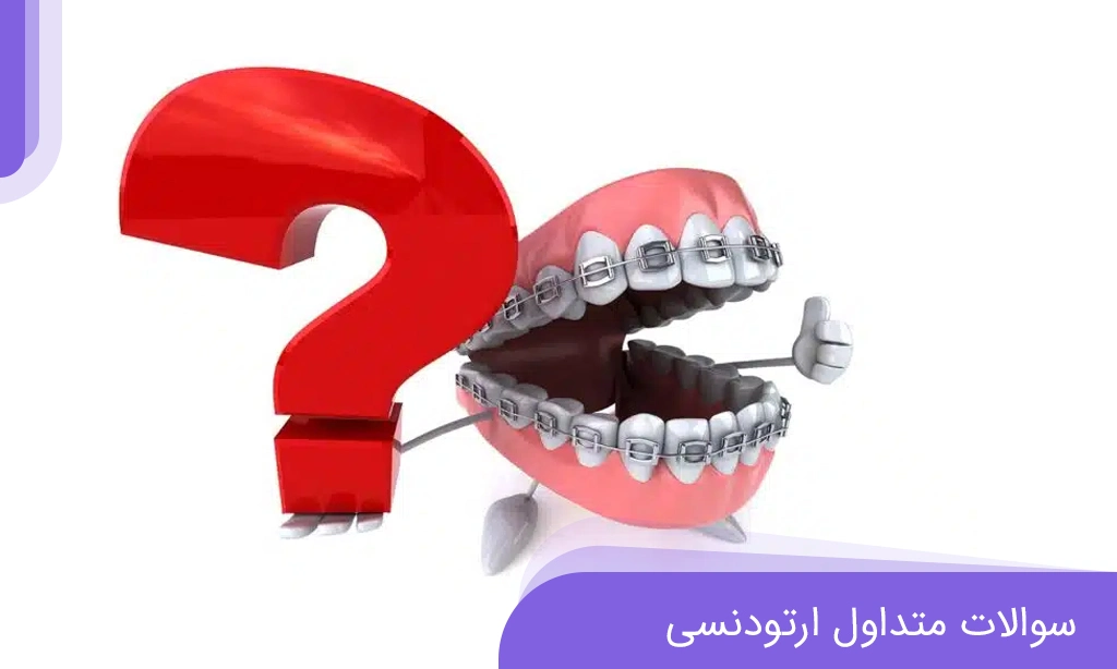 سوالات رایج ارتودنسی که اکثر بیماران می پرسند | دکتر خدوی