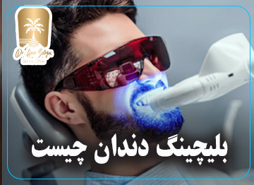 جدول تكلفة تبييض الأسنان وعينة من الصور قبل وبعد التبييض