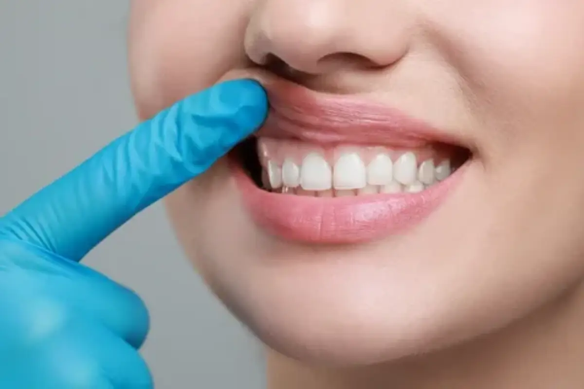 What is leukoplakia? Symptoms, causes, diagnosis and treatment methods