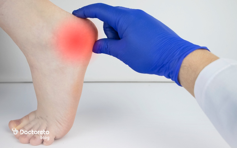 ما هي أعراض آلام الكعب؟ أعراض ومضاعفات وعلاج آلام الكعب