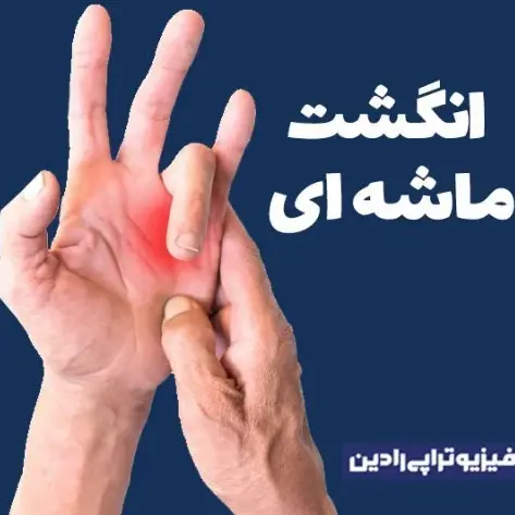 فیزیوتراپی انگشت ماشه ای - قفل شدن انگشت - کلینیک فیزیوتراپی رادین