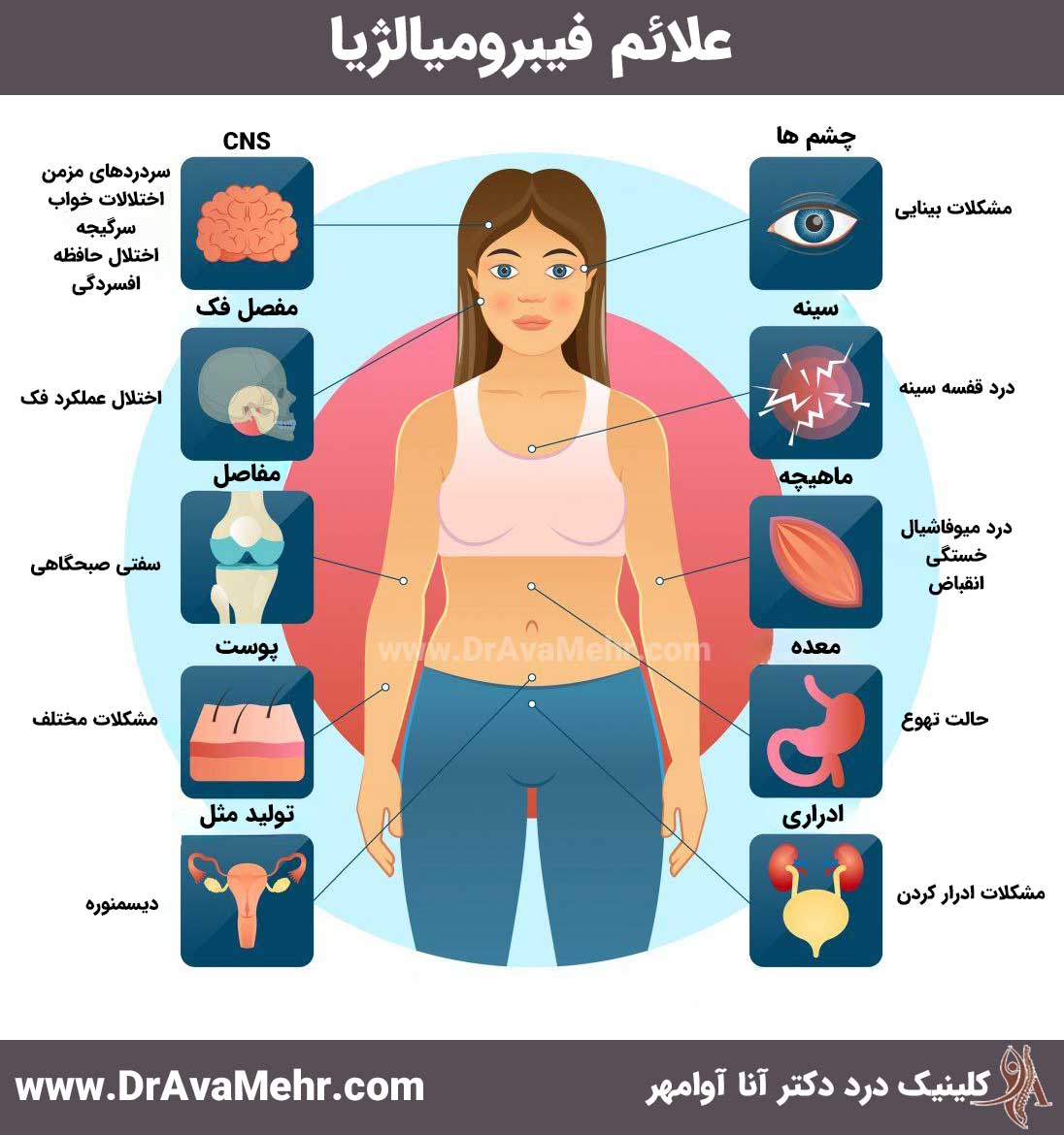 What is fibromyalgia? Cause, prevention, side effects and treatment - Dr. Anna Avamehr