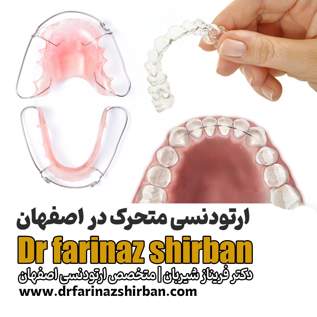 ارتودنسی متحرک در اصفهان دکتر فریناز شیربان