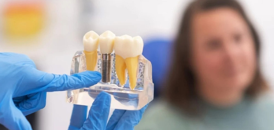 Dental implant complications: from infection to prevention methods