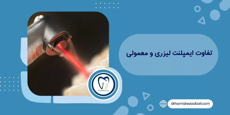 ما هو الفرق بين الليزر والزرعات التقليدية؟ | دكتور حميدرضا أفضلي