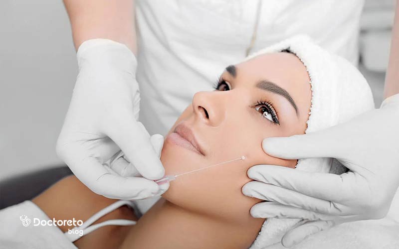 ما هو سبب تقصف خيوط شد الوجه؟