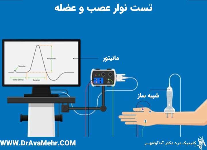 What is nerve and muscle tape and what is its use? - Dr. Anna Avamehr