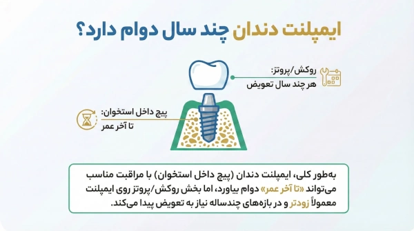 How many years does the implant last? The secret of long-lasting implants - Center for Gum and Implant Surgery, Dr. Affir and Dr. Shanae