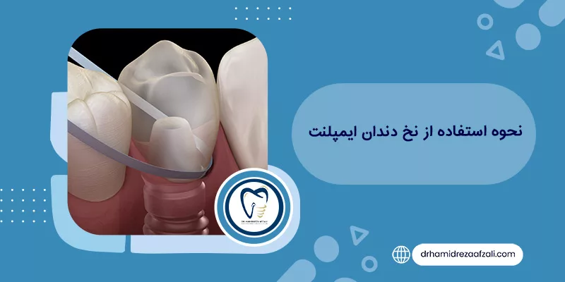 كيفية استخدام خيط تنظيف الأسنان للدكتور حميدرضا أفضلي