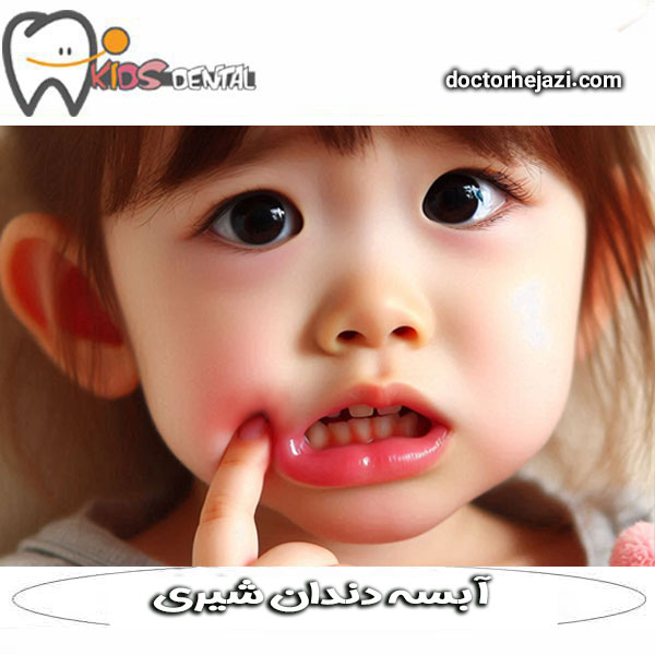 Baby tooth abscess + Dr. Mandana Hejazi in Tehran