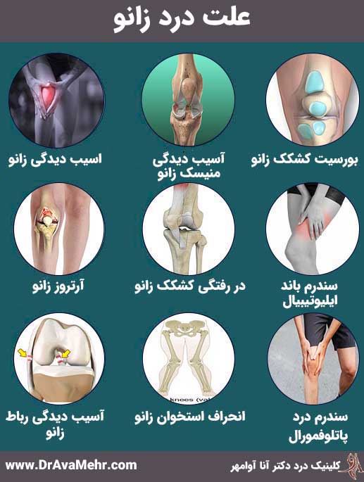 أسباب آلام الركبة والتعريف بأفضل طرق علاجها