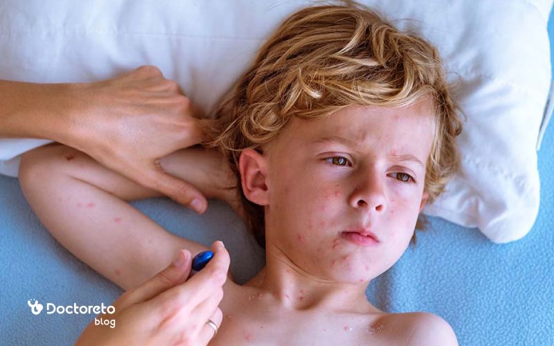 ما هي الحبوب المضادة للدجاج الأكثر فعالية؟