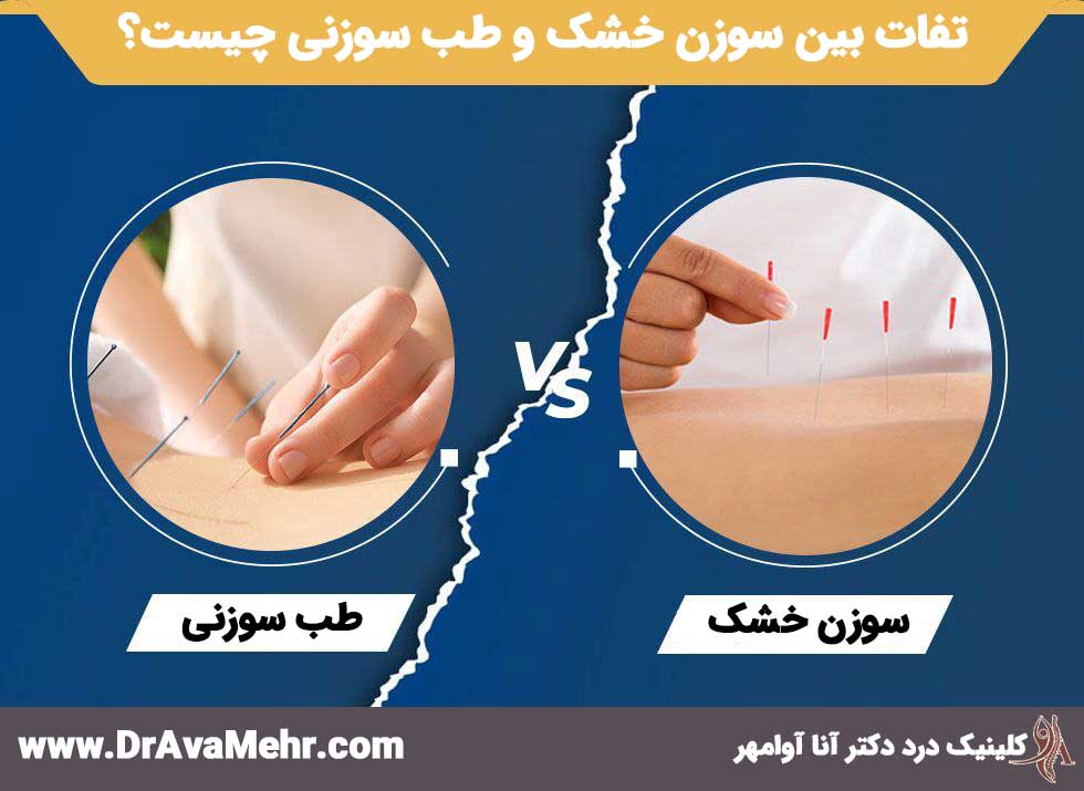 ما هو الوخز بالإبر الجافة، وكيفية استخدامه، واستخداماته، وفوائده، وآثاره الجانبية