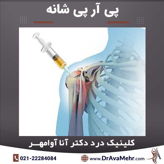 PRP shoulder - uses, durability, cost, benefits and complications