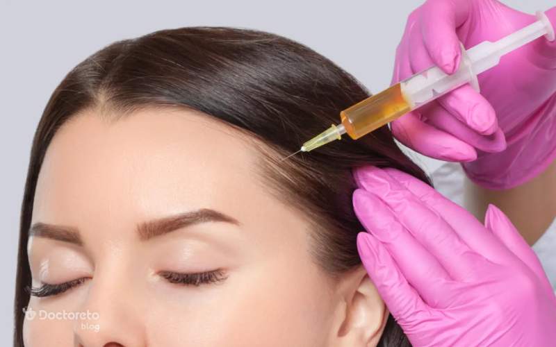 آشنایی با بهترین برند پرکننده مو در بازار