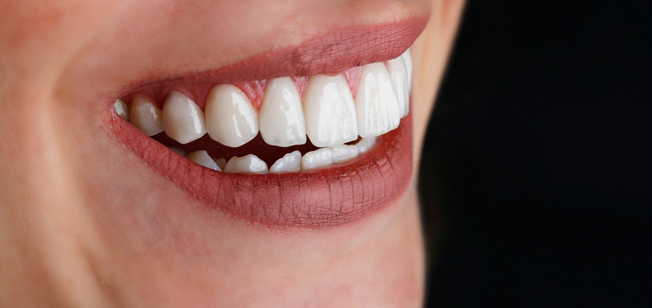 Tooth sharpener for tooth laminate