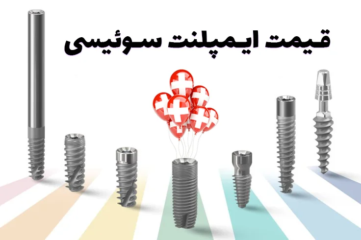 قیمت ایمپلنت سوئیسی 1404 (بهترین برند ایمپلنت سوئیسی)