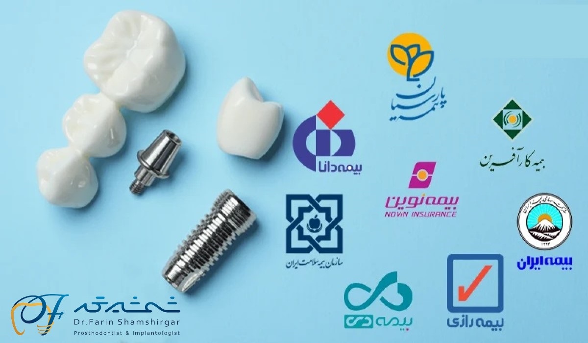 Dental implant cost with insurance: calculations you should know before taking action