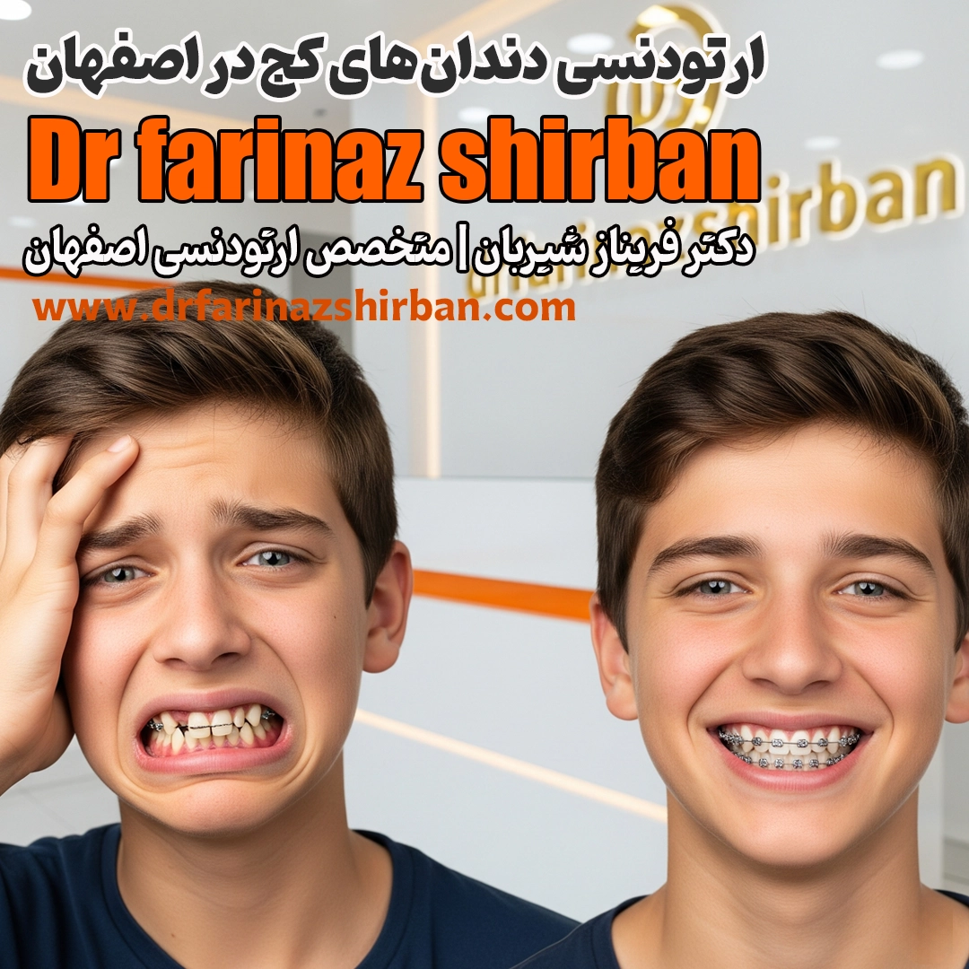 ارتودنسی دندان های کج در اصفهان درمان با دکتر فریناز شیربان