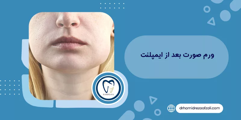 تورم الوجه بعد الزراعة + طرق العلاج د. حميد رضا أفضلي