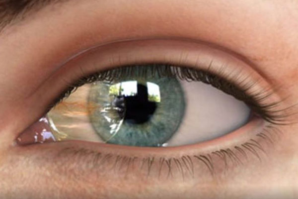 Eye pterygoid surgery, prevention methods and disease symptoms