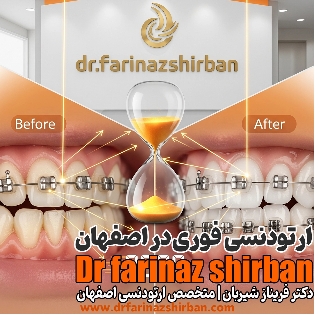 تقويم الأسنان العاجل في أصفهان: ابتسامة أنيقة في أقصر وقت ممكن