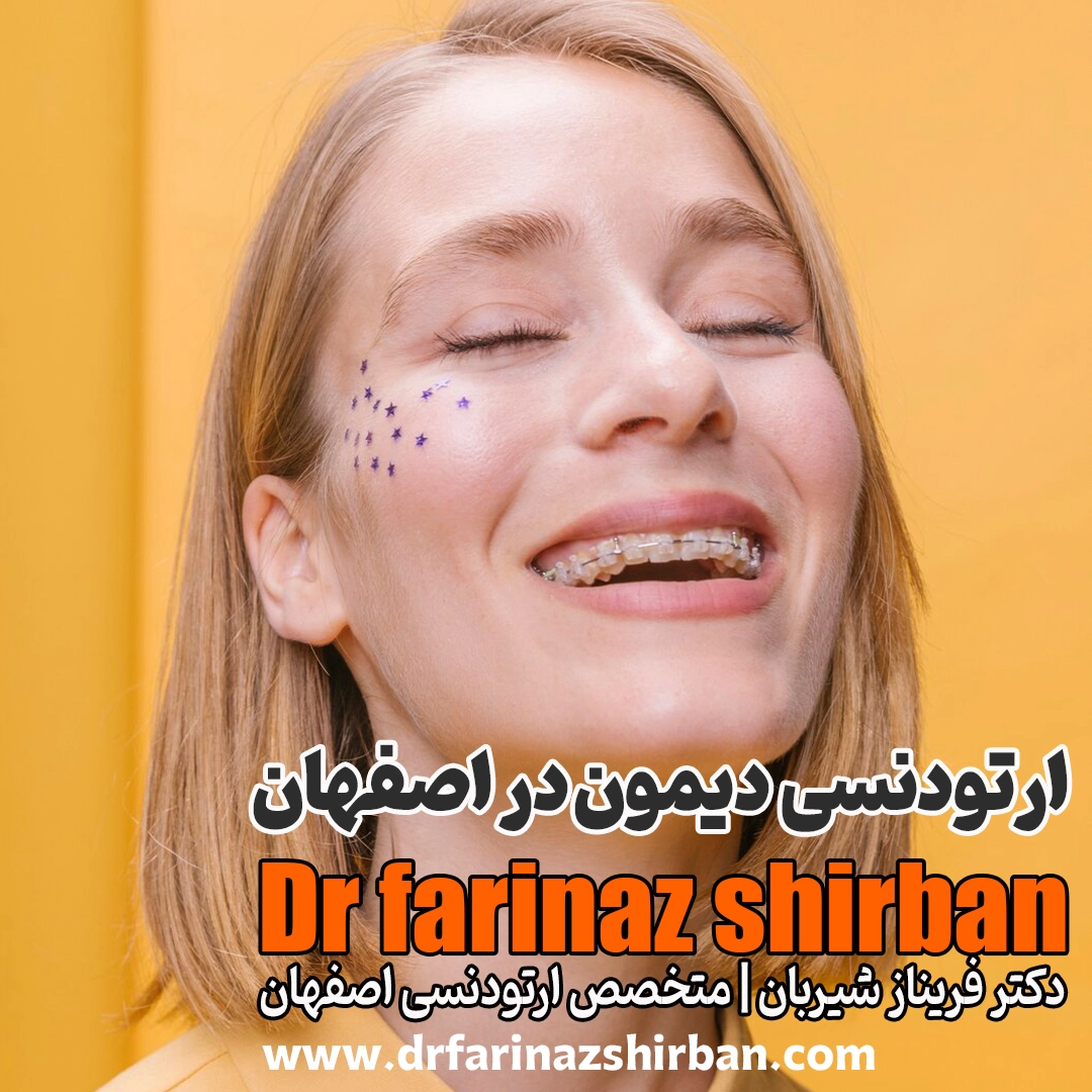 ارتودنسی دیمون در اصفهان درمان سریع و بدون درد با دکتر شیربان