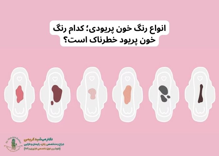 Types of period blood colors; Which color of period blood is dangerous?