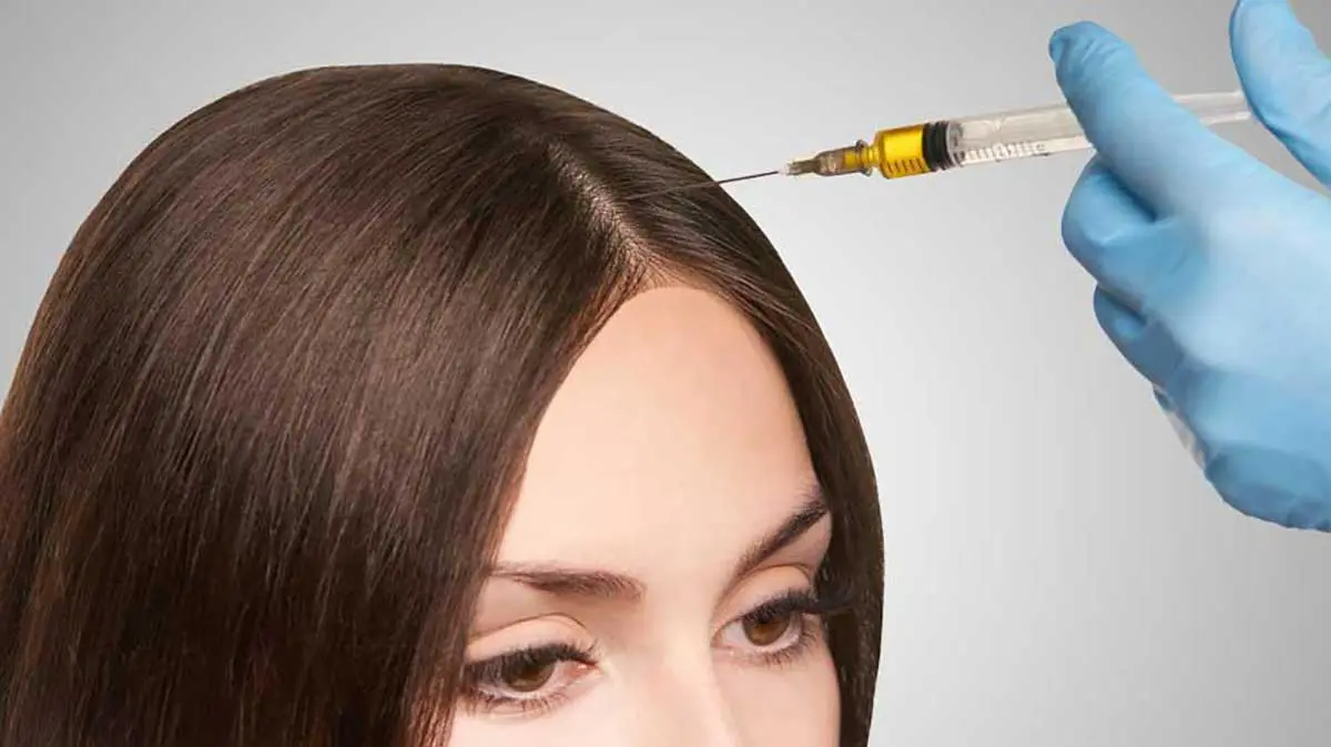 پی آر پی مو بهتر است یا مزوتراپی مو؟