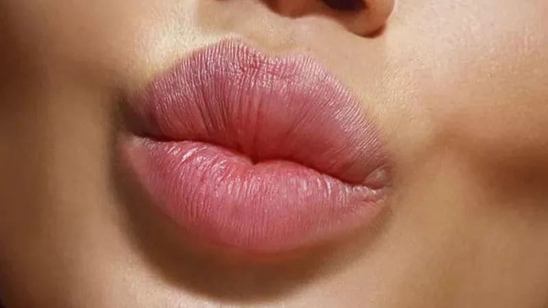 تزریق ژل لب + هزینه فیلر لب