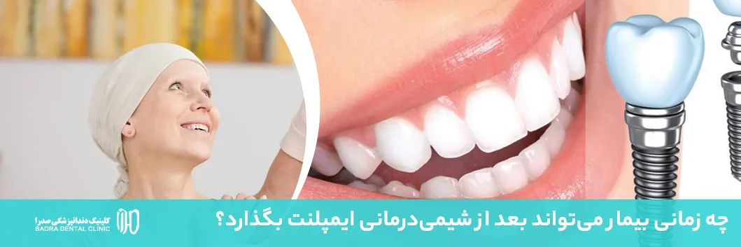 ایمپلنت و شیمی درمانی شیراز مشاوره رایگان سرطان و ایمپلنت دندانپزشکی صدرا
