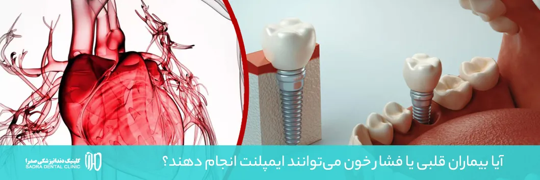 ایمپلنت و بیماران قلبی یا فشار خون