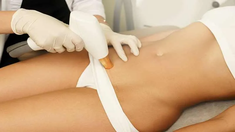 لیزر موهای زائد در دوره پریود