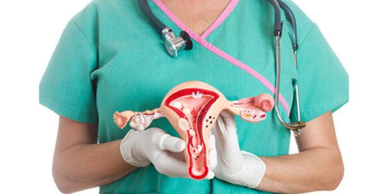 درمان کیست تخمدان در زنان دکتر صدیقه آخان طبیب متخصص زنان و زایمان